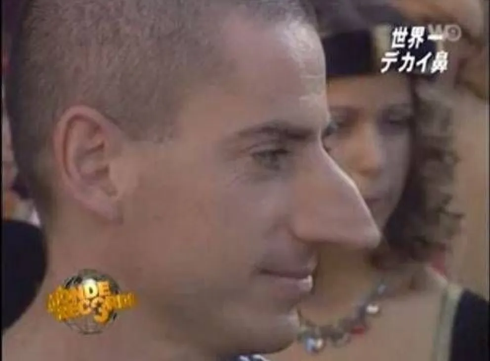 Tiene la nariz más grande del mundo