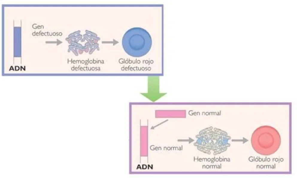 Talasemia: Una Anemia Hereditaria