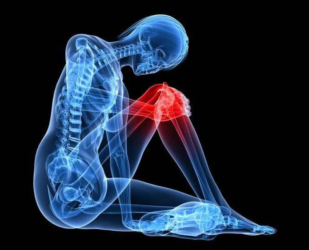 Preguntas frecuentes sobre la artritis