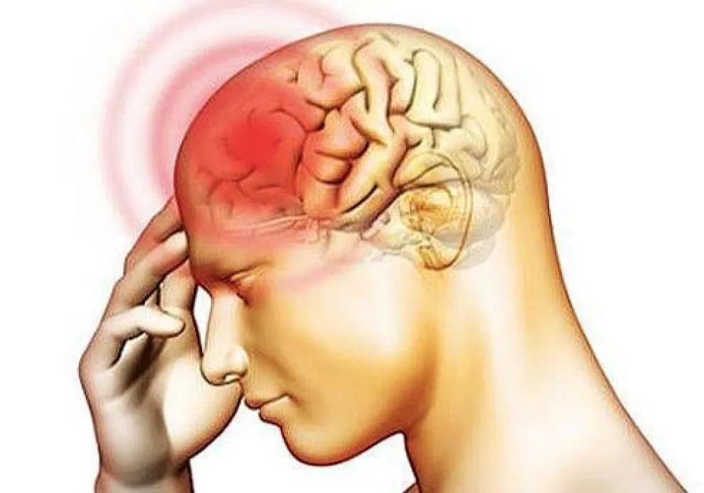 Qué es la Meningitis