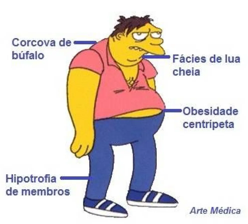 Qué es el Sindrome de Cushing