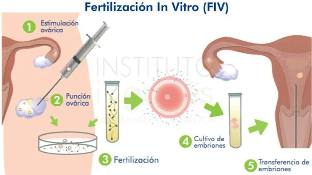 Técnica asistida de alta complejidad: Fertilización In Vitro