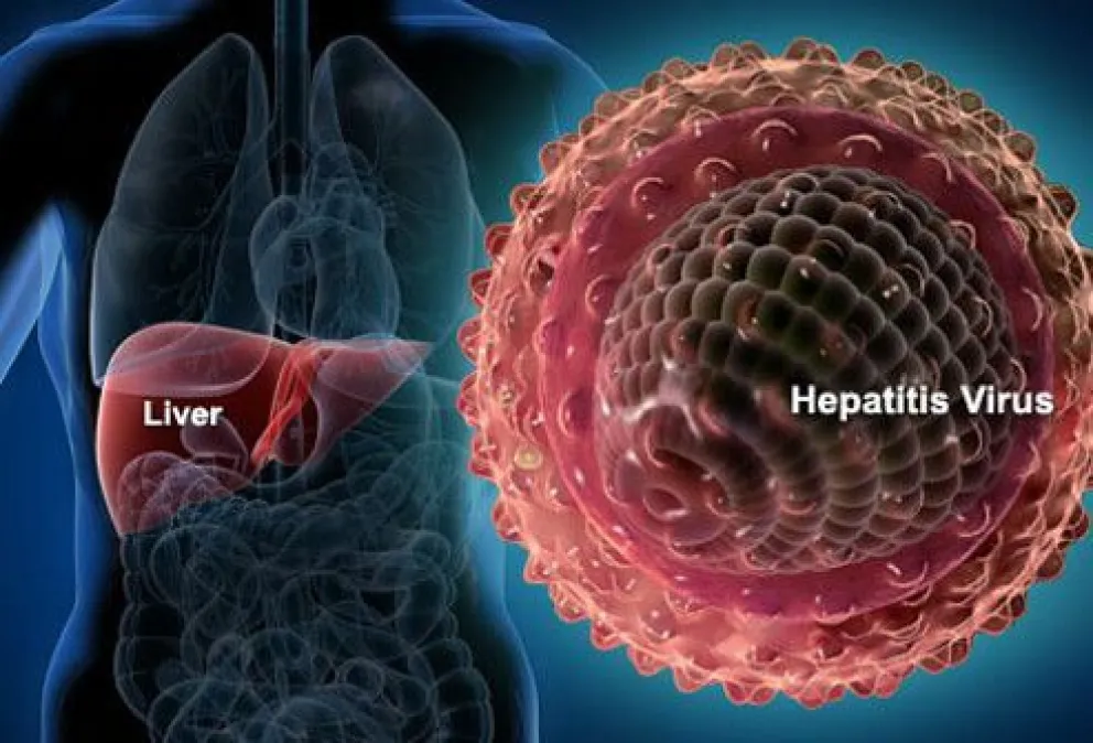 Hepatitis inducida por medicamentos
