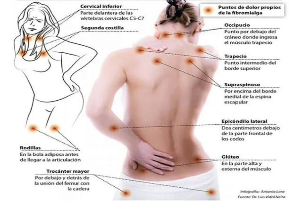 Qué es la Fibromialgia y el síndrome de fatiga crónica